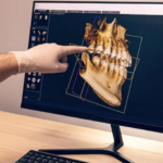 Odontologia estética avança com técnicas minimamente invasivas e muda perfil de tratamentos em Campo Grande